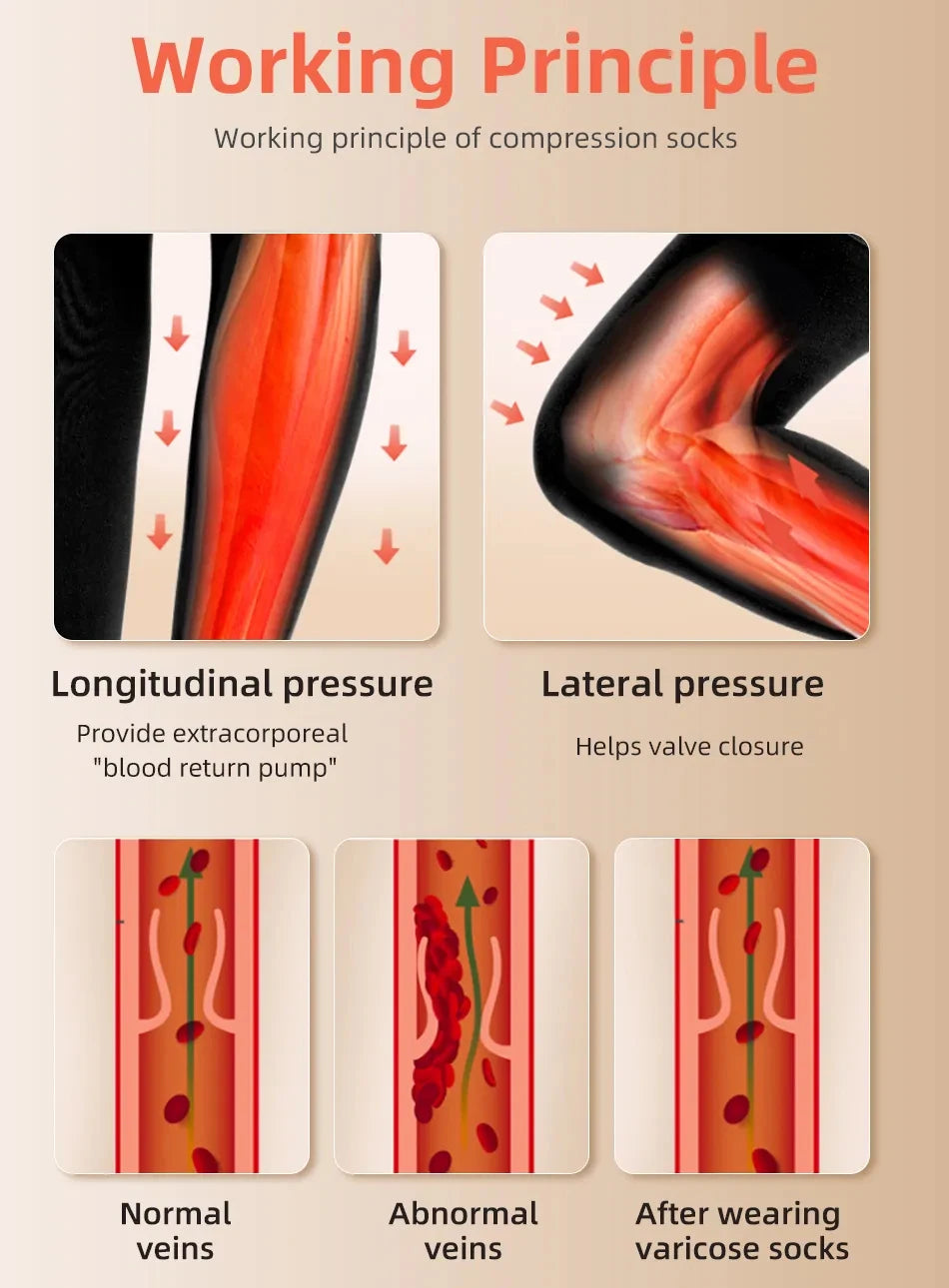 1Pair Thigh High Compression Stockings for Women,Open Toe, 20-30 mmHg Graduated Medical Compression Stockings for Edema